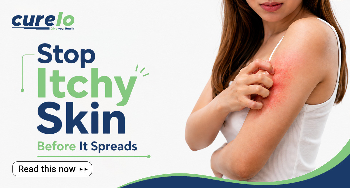 Common skin allergy causes, rashes, and home treatment guide infographic.