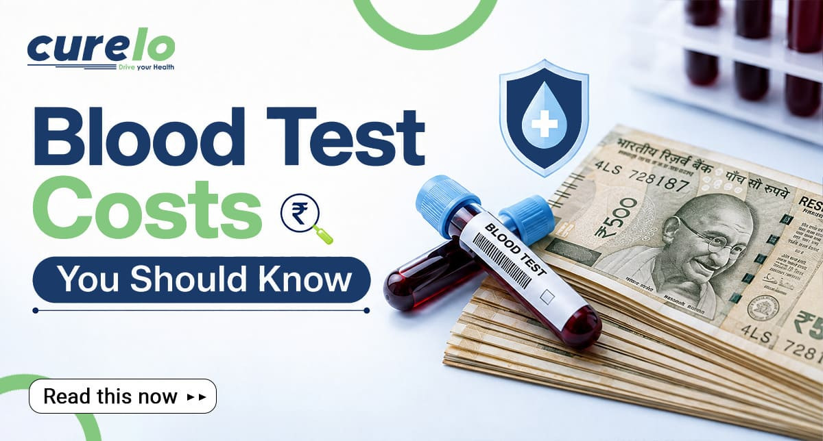 Blood test cost guide featuring test tubes and a diagnostic checkup list