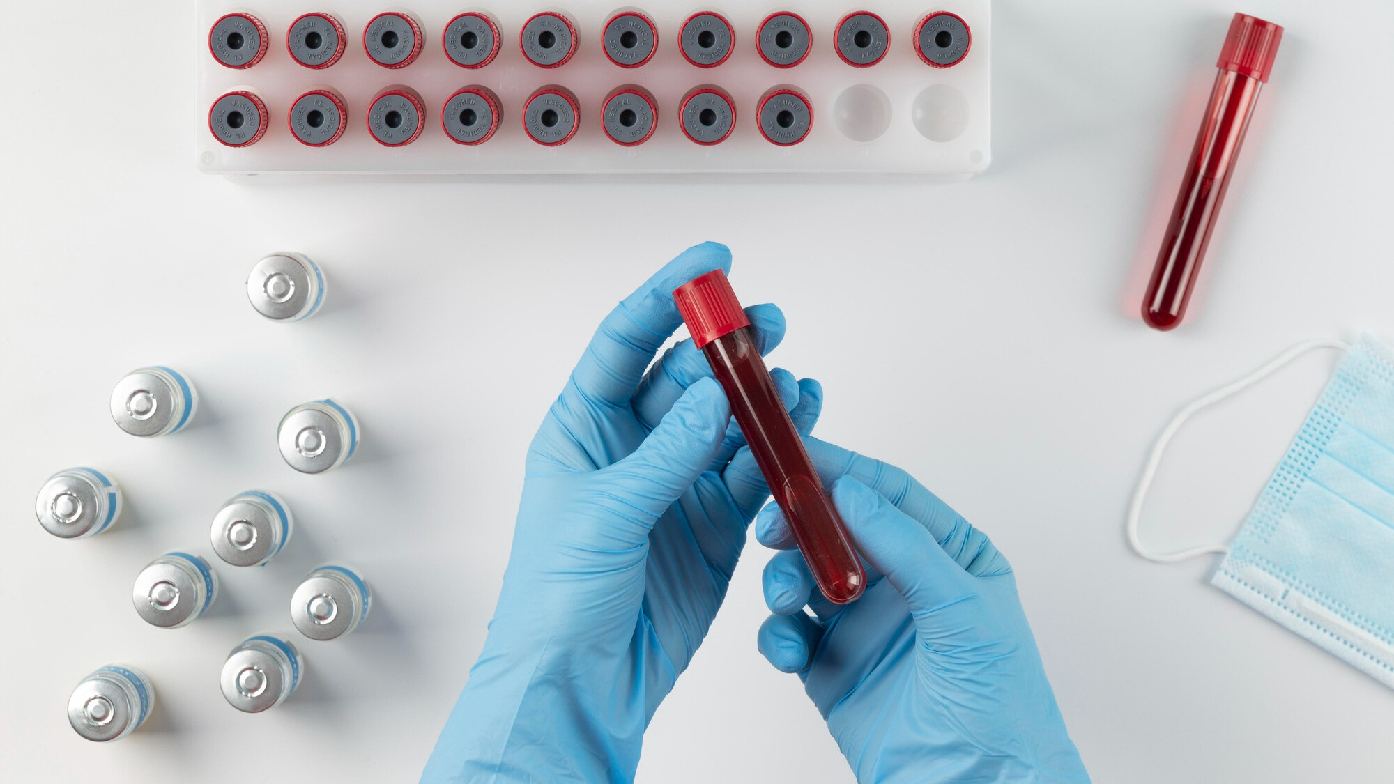 Unlocking the Essentials: 5 Things You Need to Know About Lipid Profile