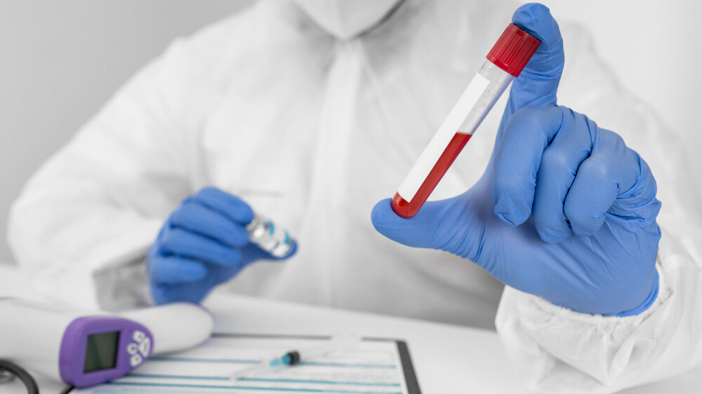 Understanding Routine Blood Tests: What Do the Results Mean?
