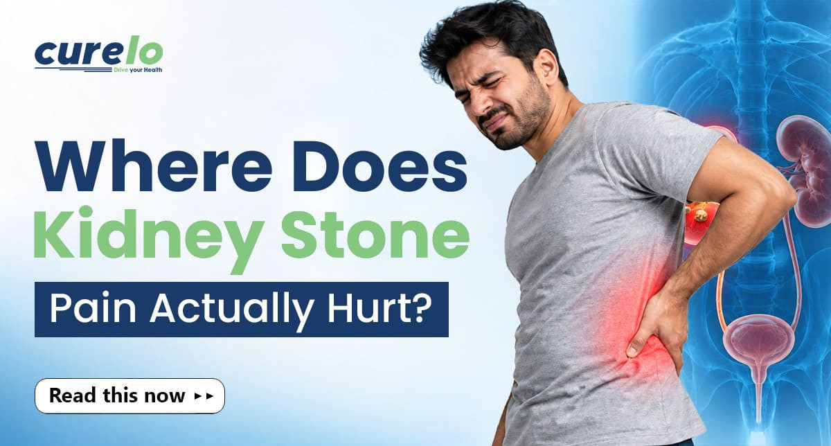 Diagram showing kidney stone pain location traveling from side to lower abdomen