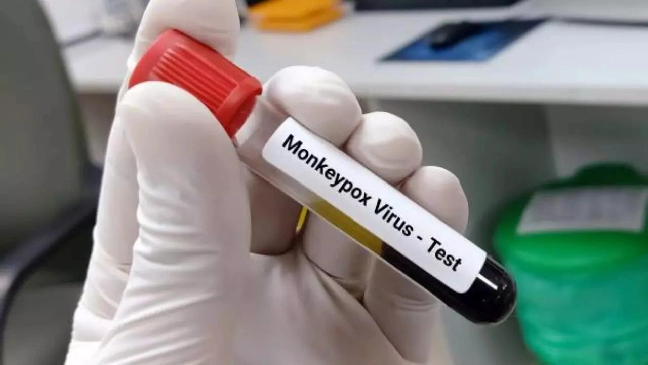 Monkeypox Virus Detected in Pakistan: Essential Information You Need to Know Monkeypox Virus Detected in Pakistan: Essential Information You Need to Know