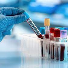 Lab Image