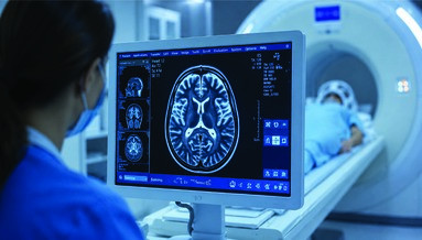 MRI MRI